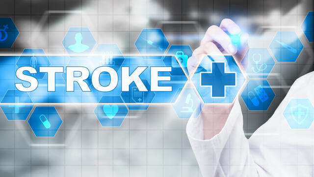 Abstract background with the word stroke